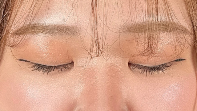 手术后的状态 其一