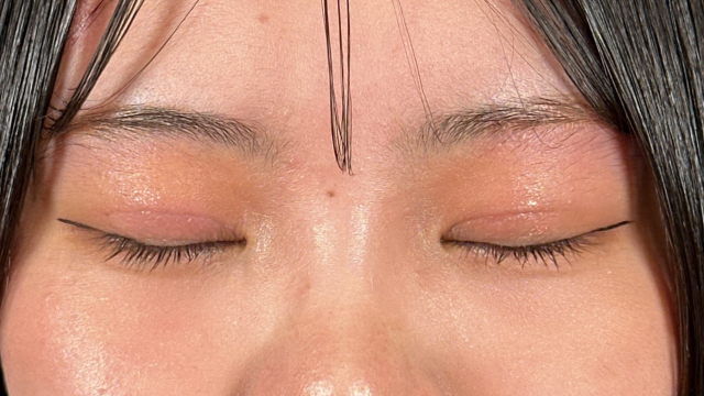 Postoperative Condition Part 1