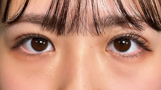 手术后的状态 其一