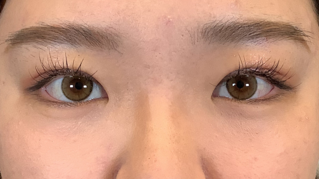 手术后的状态 其一