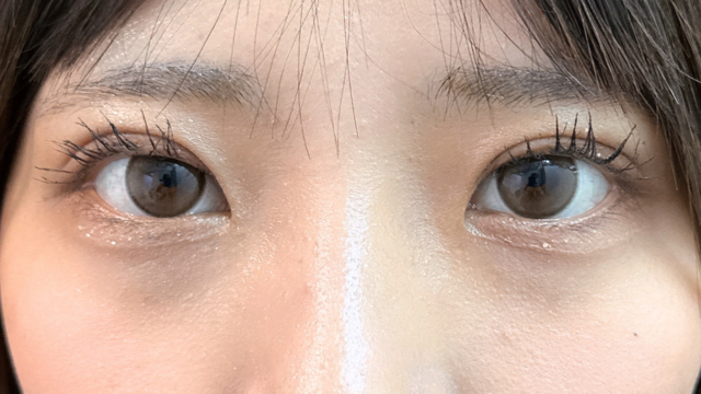 手术后的状态 其一