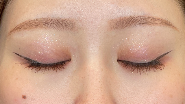 Postoperative Condition Part 1