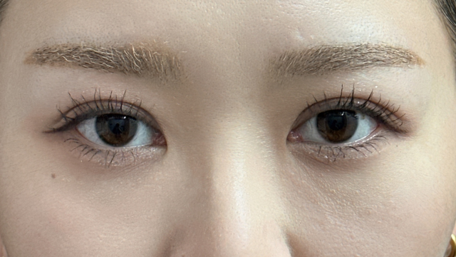 手术后的状态 其一