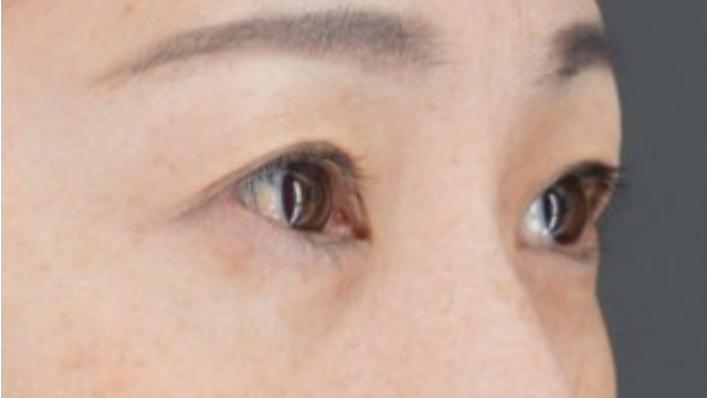 手术后的状态 其一