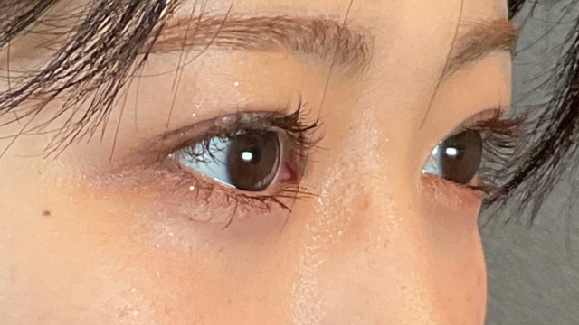 手术后的状态 其一