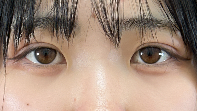 Postoperative Condition Part 1