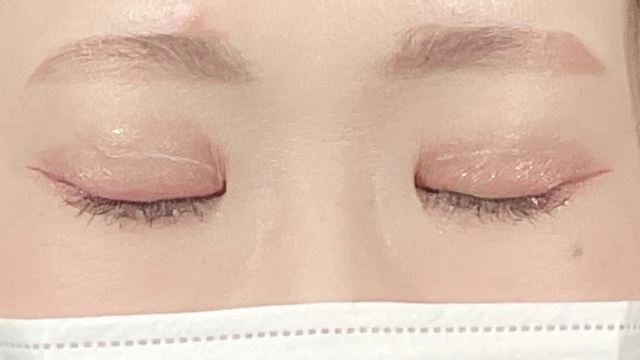 Postoperative Condition Part 1