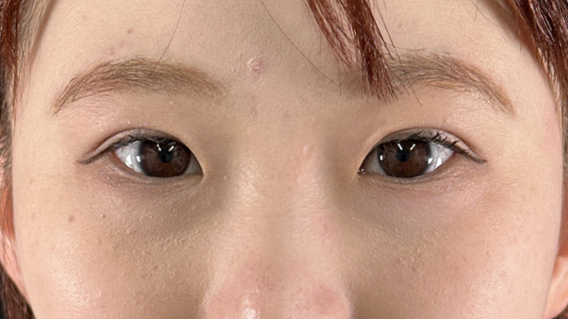 Postoperative Condition Part 1