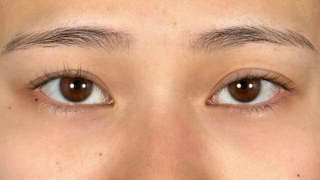 手术前的状态 其一