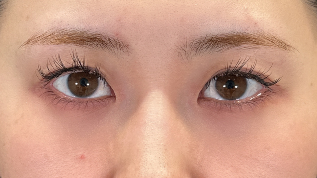 手术前的状态 其一