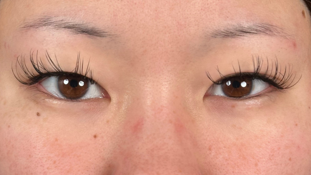 手术前的状态 其一