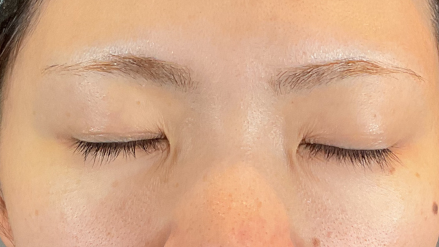 手术前的状态 其一