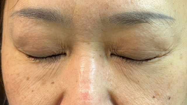 Postoperative Condition Part 1