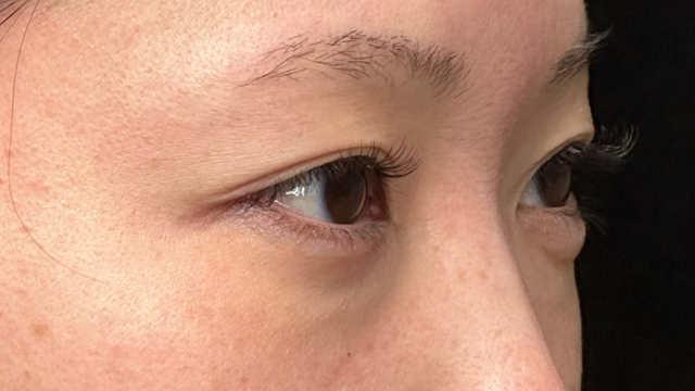 Postoperative Condition Part 1