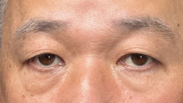 手术前的状态 其一