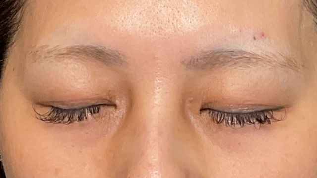 Postoperative Condition Part 1