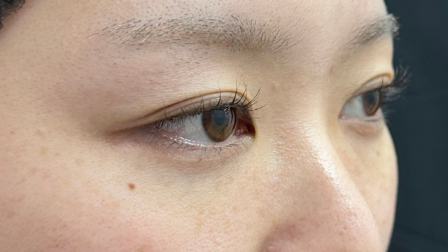 手术前的状态 其一