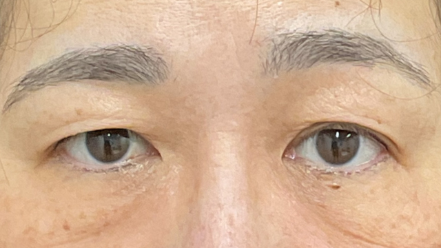 Postoperative Condition Part 1