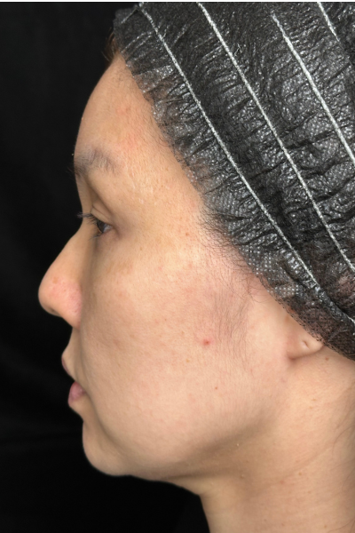 手術前の状態 その1