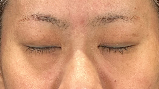 Postoperative Condition Part 1