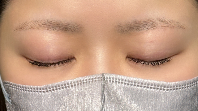 手术前的状态 其一