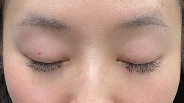 手术前的状态 其一