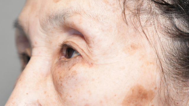 Postoperative Condition Part 1