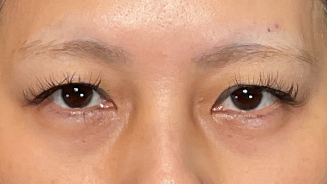 Postoperative Condition Part 1