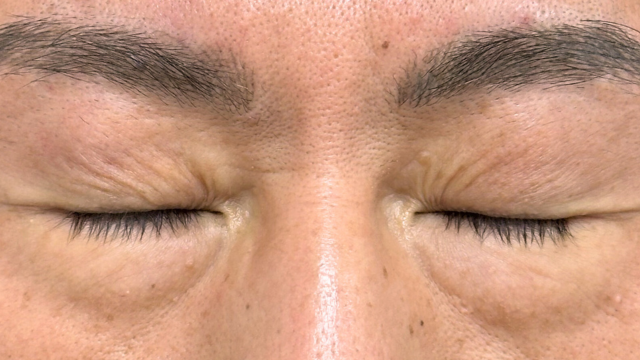 手术前的状态 其一