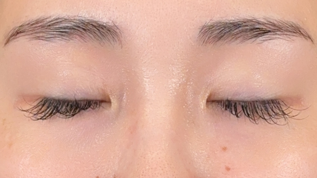 手術前の状態 その1