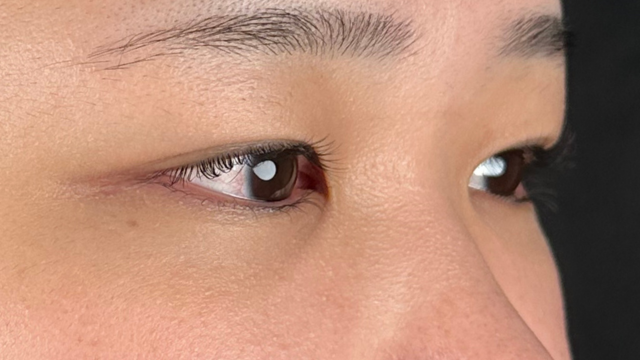 手术前的状态 其一