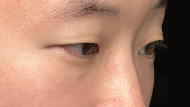 Postoperative Condition Part 1