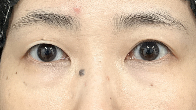 Postoperative Condition Part 1