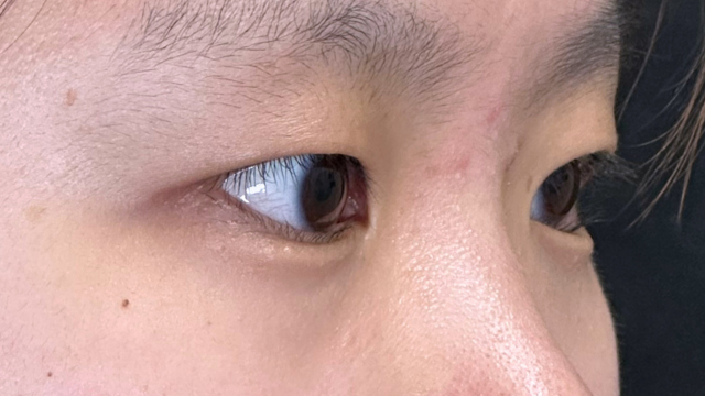 手术前的状态 其一