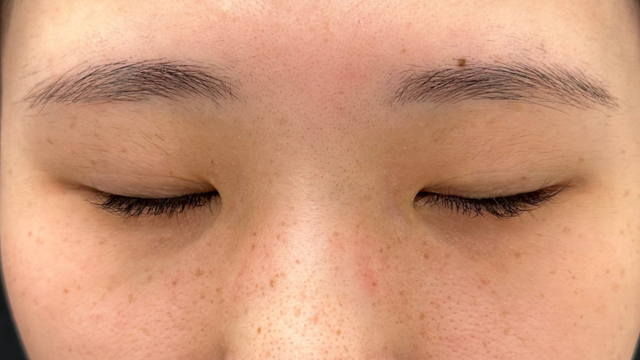 手术前的状态 其一