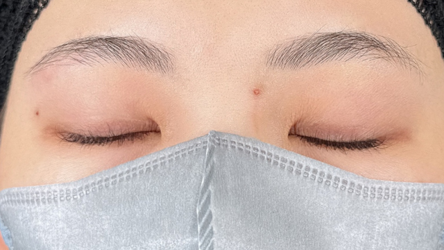 Postoperative Condition Part 1