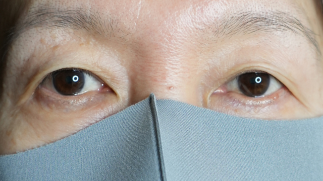 手术前的状态 其一