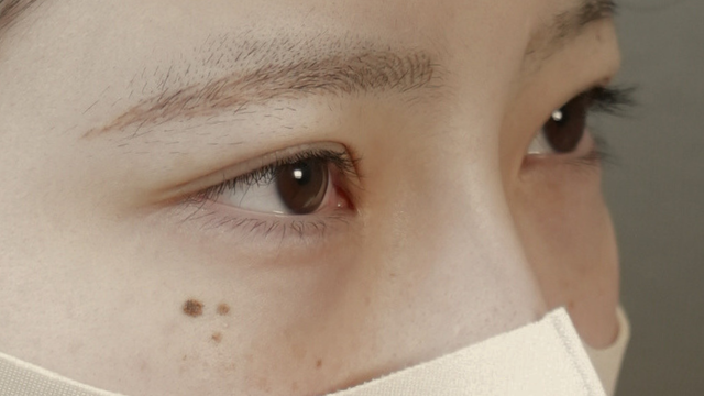 手術前の状態 その1