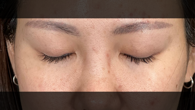 Postoperative Condition Part 1