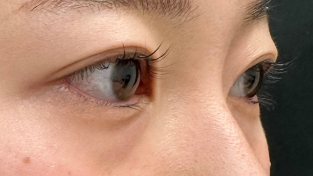 手术前的状态 其一