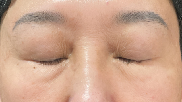 手术前的状态 其一