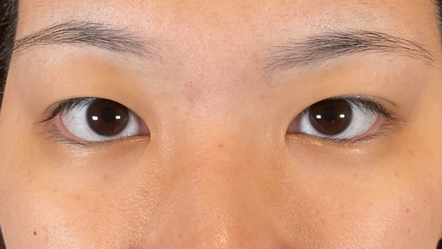 手术前的状态 其一