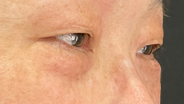 手術前の状態 その1