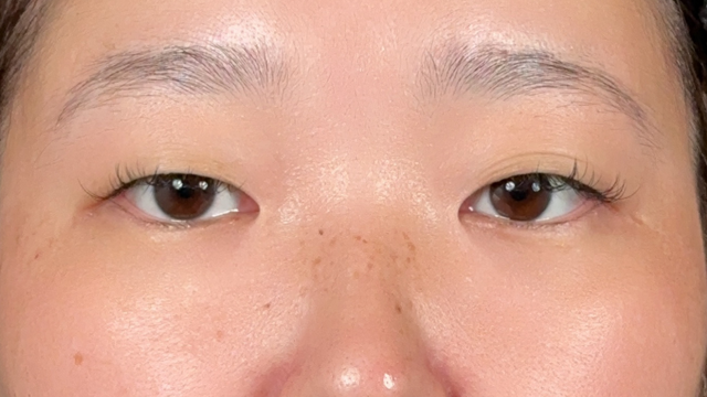 手术前的状态 其一