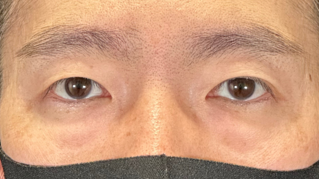 手术前的状态 其一