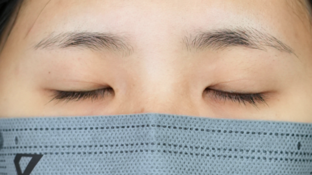 手术前的状态 其一