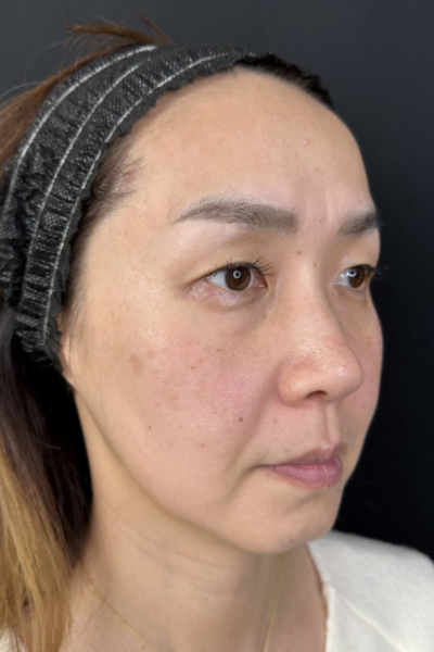 手术前的状态 其一