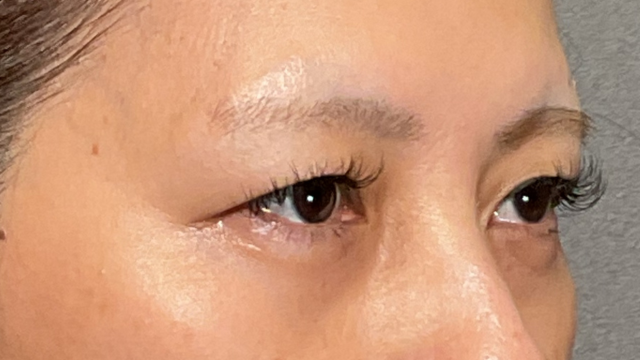 Postoperative Condition Part 1