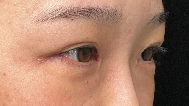 手术前的状态 其一