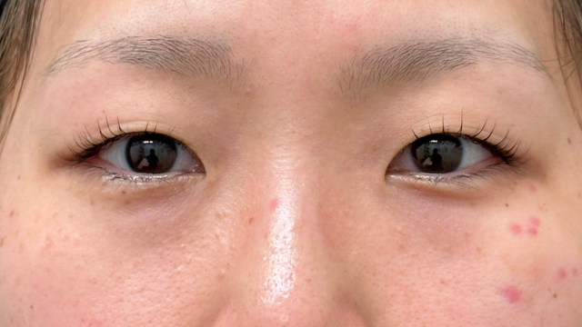 手术前的状态 其一